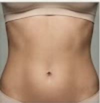 Bauch